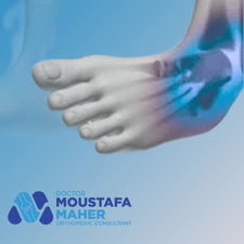 علاج التواء الكاحل