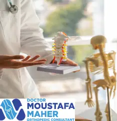 أفضل دكتور تشوهات عظام أطفال في مصر